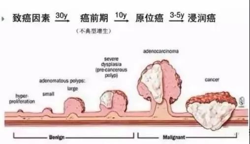 运城众泰肛肠医院：得了肠息肉最怕吃什么？