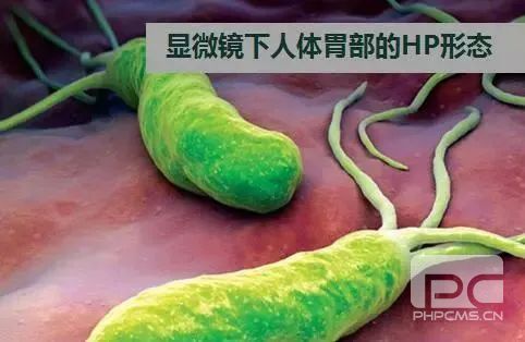 运城众泰肛肠医院：幽门螺杆菌的传染途径是什么