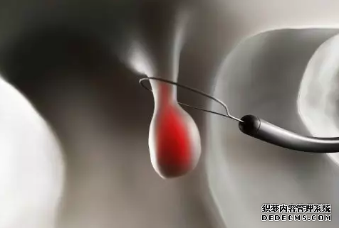 运城众泰肛肠医院：肠息肉究竟有没有症状？