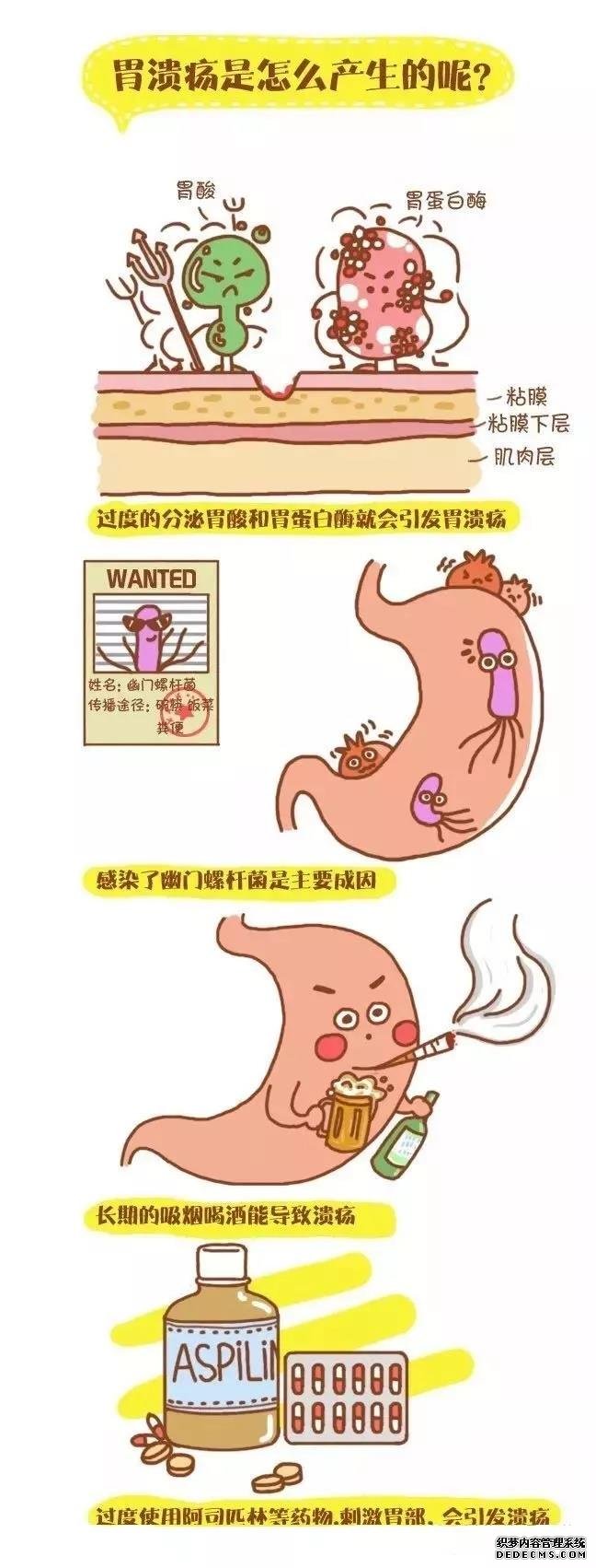 运城众泰肛肠医院：6个预防胃溃疡癌变招数