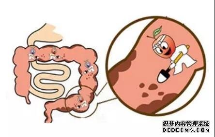 运城众泰肛肠医院：便秘，你会调理吗？