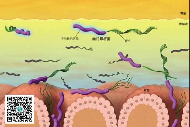 运城众泰肛肠医院：慢性浅表性胃炎，需要治疗吗