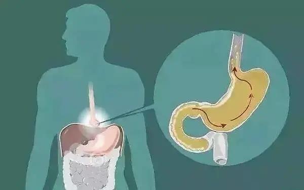 运城众泰肛肠医院：胃窦炎就是胃炎？生活中该如何预防