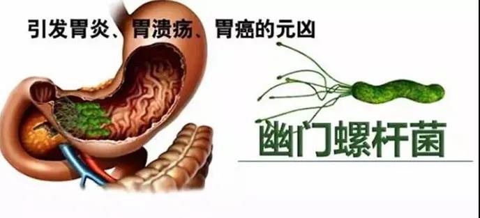 运城众泰肛肠医院：哪些人是感染幽门螺旋杆菌的高危人群？