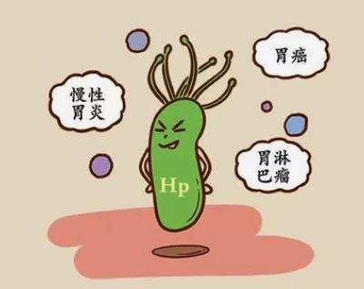运城众泰肛肠医院：朋友圈传的胃里糜烂，是因为感染了幽门螺杆菌吗？